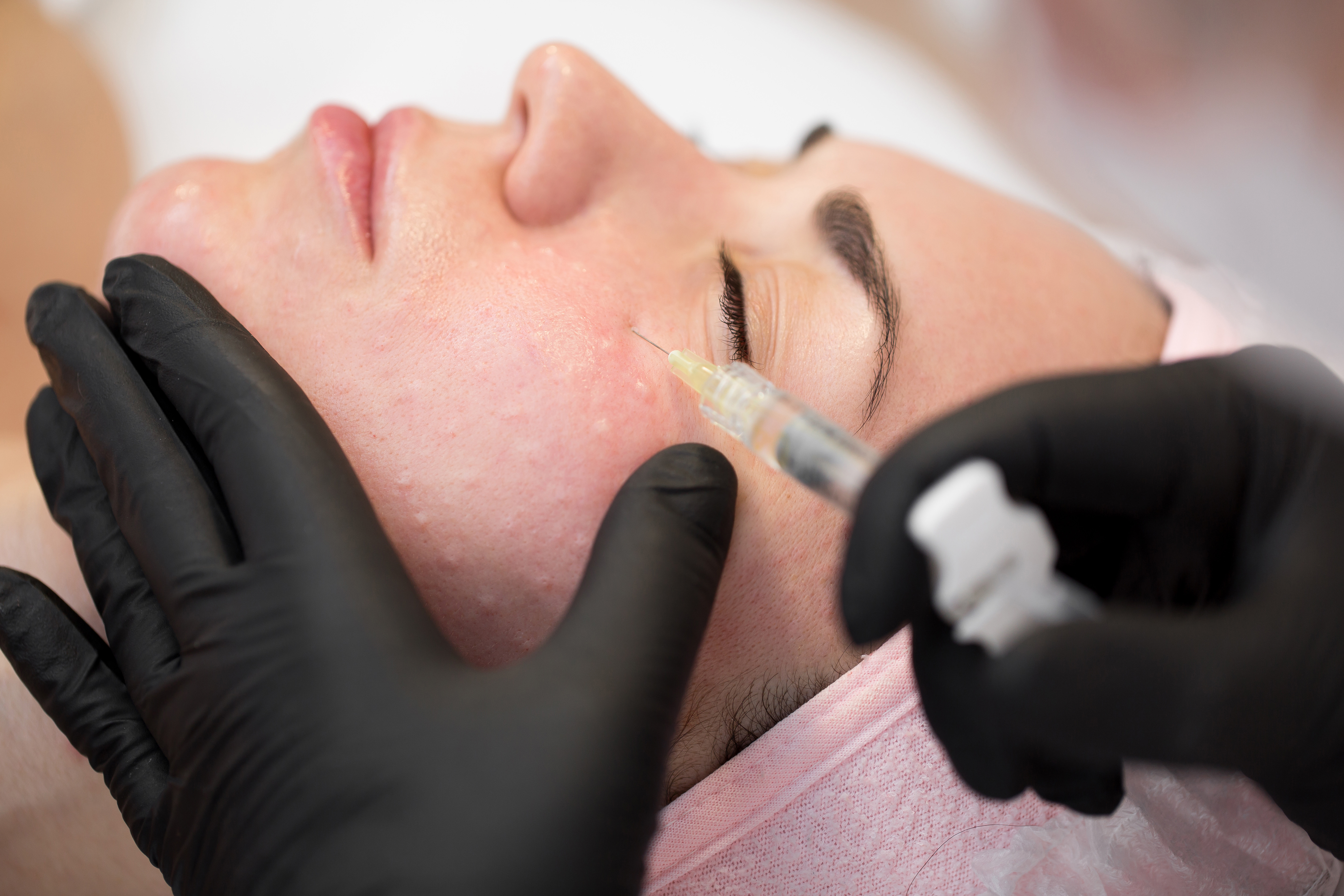 Mesotherapie Behandlung
